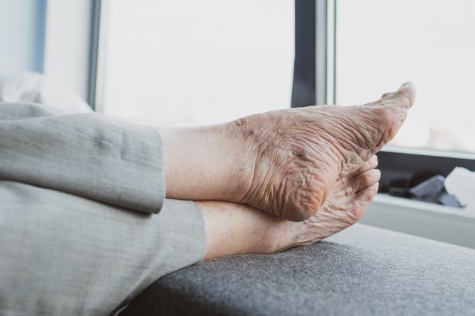 ¿Qué es el tratamiento de pie diabético para mayores y en qué consiste?